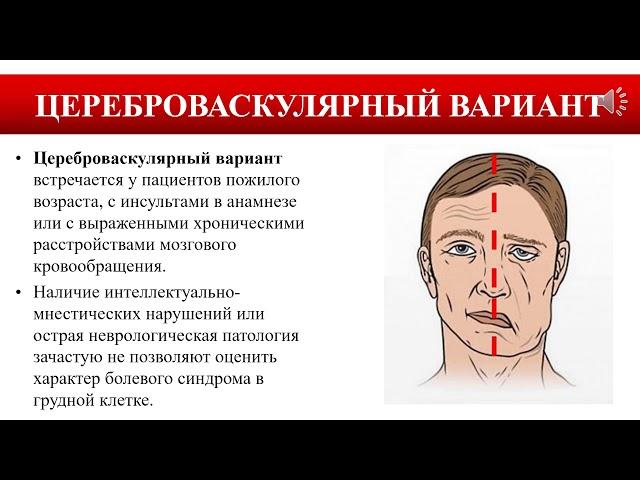 Острый коронарный синдром