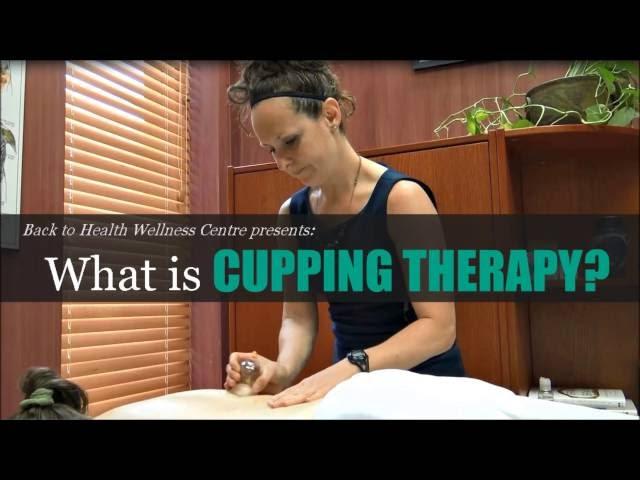 What is Cupping? How Does Cupping Therapy Work? - Back to Health Wellness Centre