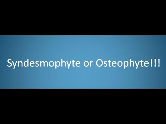 Syndesmophyte or Osteophyte!!!