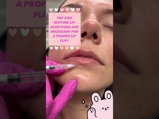 Top and Bottom Lip Injections are NECESSARY for a Proper Lip Flip!