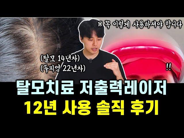 의사인 내가 레이저 탈모 치료기 12년 사용하며 느낀 것들 (feat. 병원용 vs 가정용)