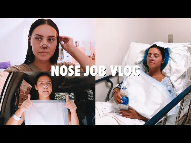 NOSE JOB VLOG | Surgery Day | Experience + Recovery