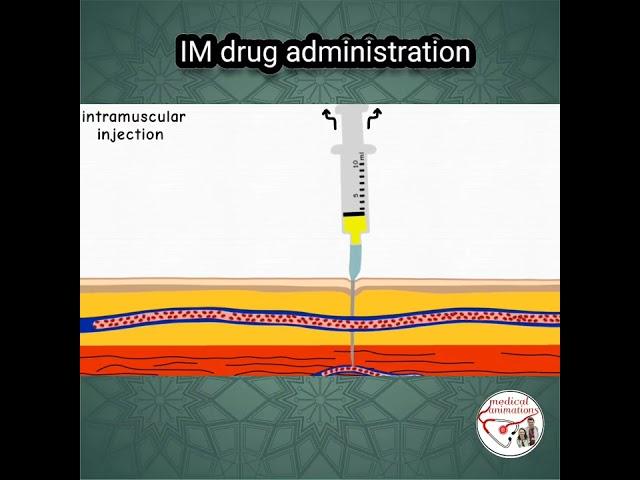  INTRAMUSCULAR (IM) INJECTION, PROCEDURE | ANIMATED EXPLANATION