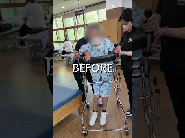 뇌졸중 환자에게 전문적인 재활치료가 필요한 이유