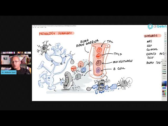 Multiple Sclerosis (MS) Clinical Aspects