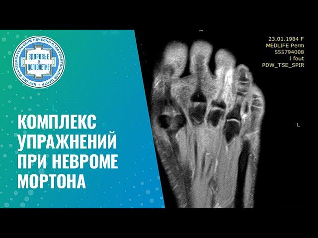  Комплекс упражнений при невроме Мортона