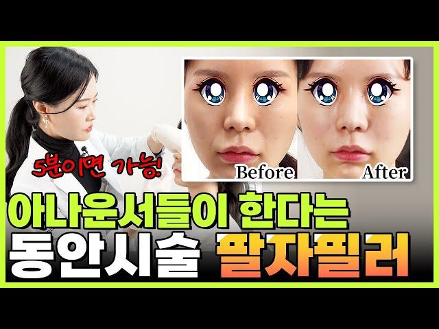 아나운서들이 한다는 10년어려지는 동안시술 팔자필러 생생후기! 부천팔자필러, 부천피부과