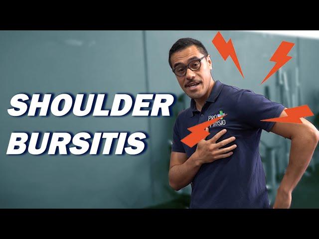 Shoulder Bursitis