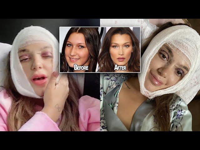 I HAD MULTIPLE PROCEDURES DONE. admitting to all my plastic surgery & showing you my experience.