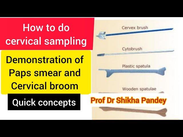 Cervical sampling methods demonstration, Pap's smear, cervical brush @saisamarthgyneclasses