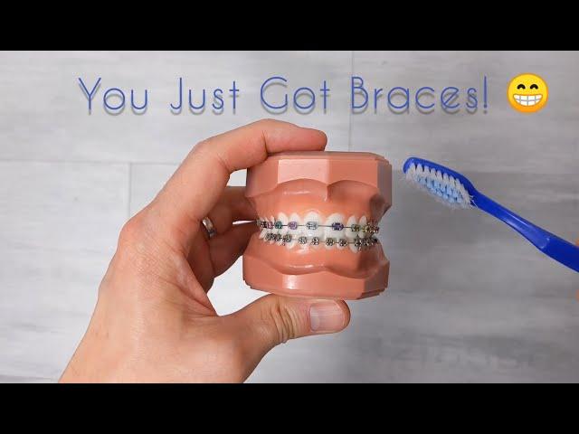 How to care for your new braces and your teeth!