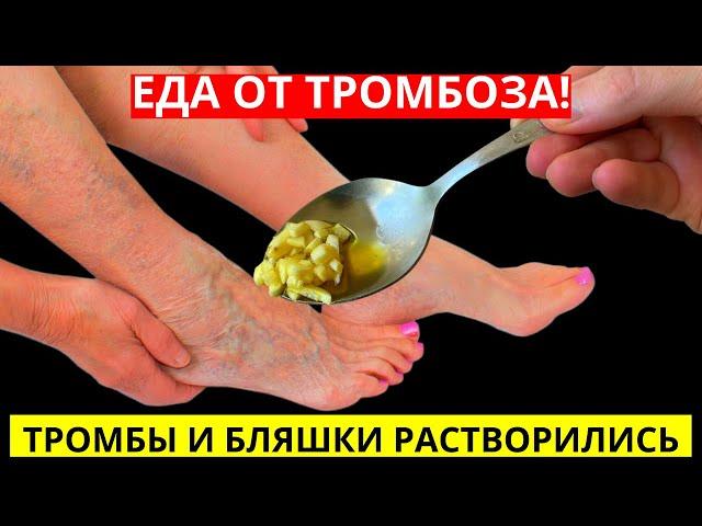 Еда от Варикоза и Тромбоза! Быстро растворяют ТРОМБЫ в сосудах... Лучше Аспирина