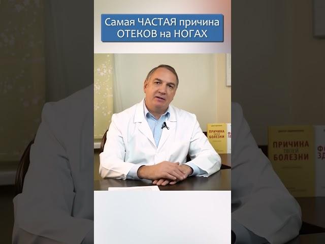 ОТЕКАЮТ НОГИ : что делать?