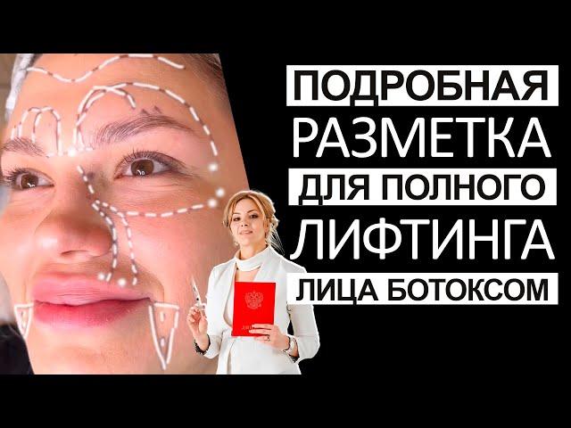 Максимально подробная разметка для полного лифтинга лица ботоксом