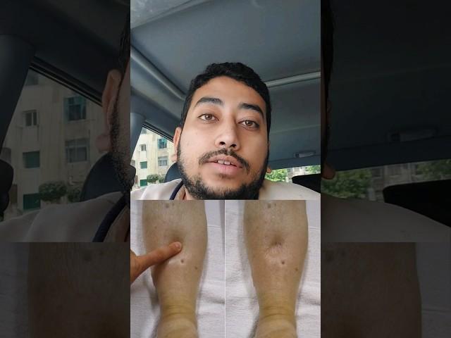 عيان الضغط ممكن تضيع حياته و تبقا انت السبب