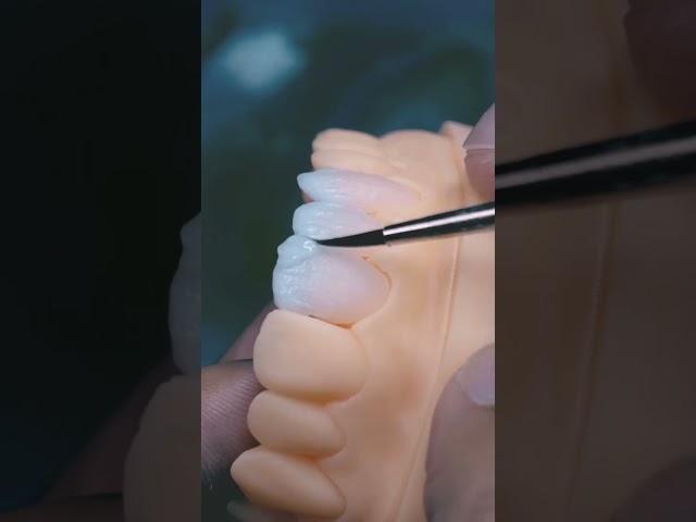 Dental ceramic build up #dentaltechnology #dental #dentalcare #dental #shorts #education #viralvideo