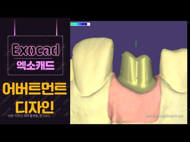 치과기공사 엑소캐드 전치부 커스텀어버트먼트 디자인 / Dental technician exocad custom abutment design