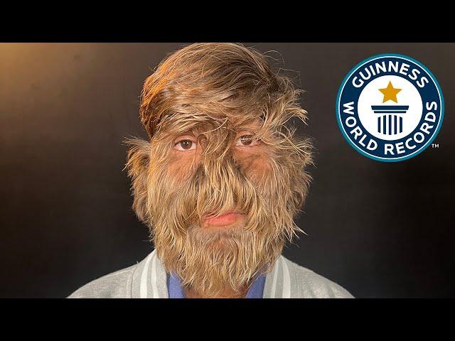 Hairiest Face - Guinness World Records