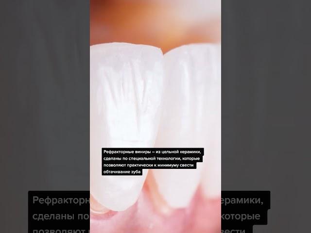 Какие виниры выбрать?