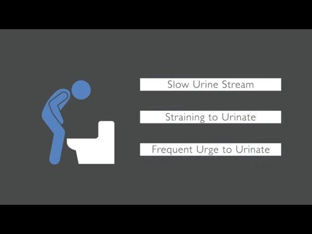 Trouble Urinating? What Causes Urinary Issues in Men