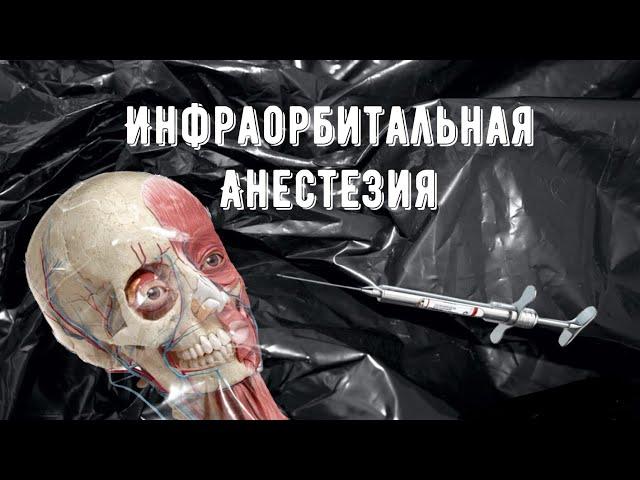 Инфраорбитальная анестезия (внутри ротовой метод)