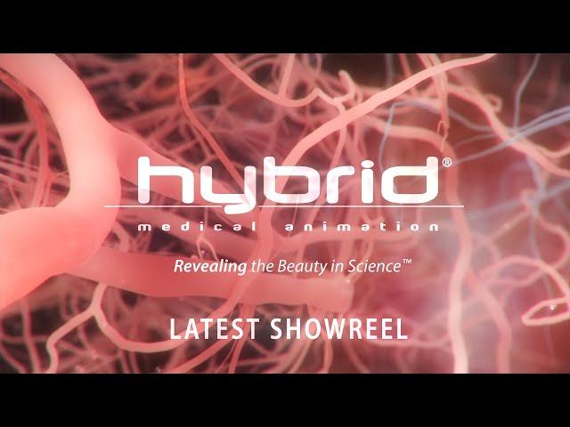 hybrid medical animation | latest showreel | #medicalanimation #showreel #demoreel #medicalvideos