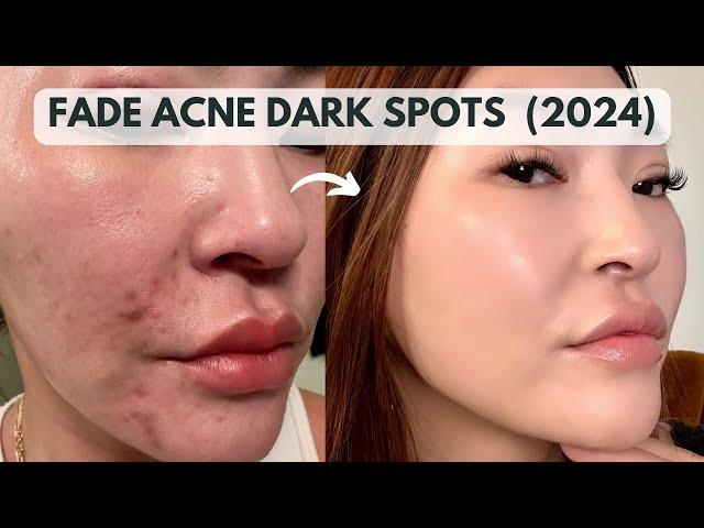 Fade Dark Spots & Hyperpigmentation From Acne (2024)