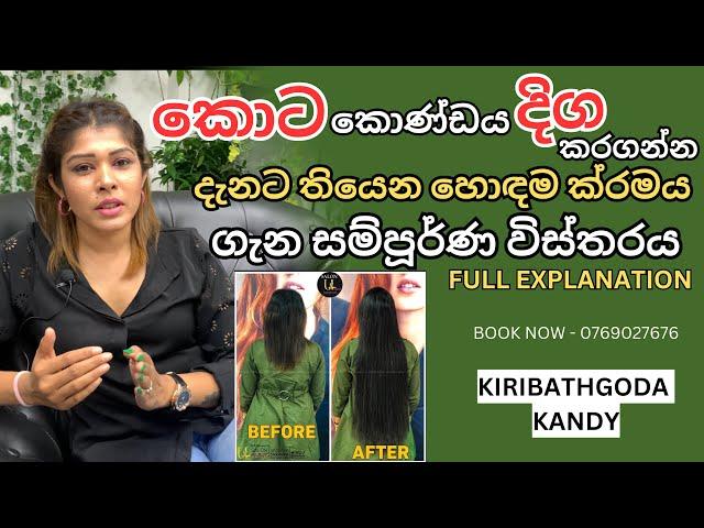 Hair Extension Methods |(කොණ්ඩය දිග කරගන්න හොදම ක්‍රමය)|Bestest Hair Extension Method|Srilanka|