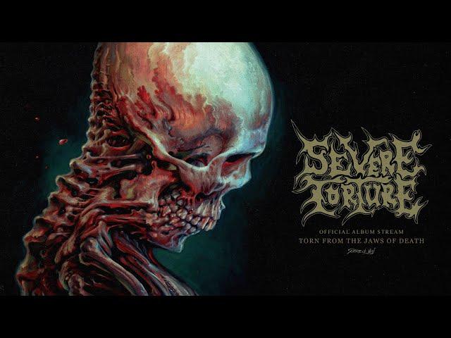 Severe Torture - 'Torn From the Jaws of Death' (Official Album Stream)