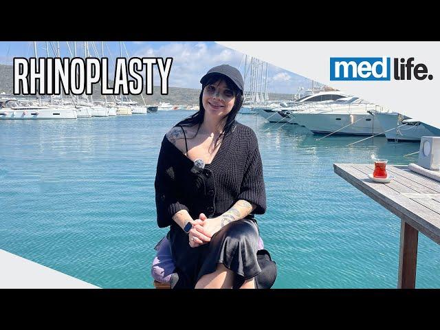 Irina's Medical Journey in Turkey | Rhinoplasty Surgery