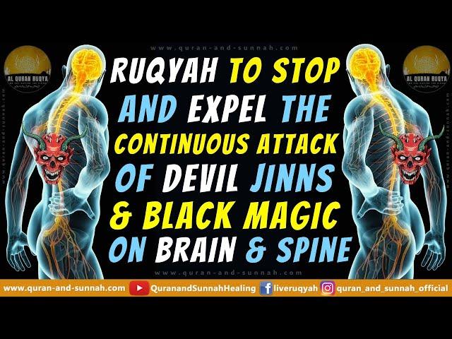 Powerful Ruqyah To Stop & Expel The Continuous Attack Of Devil Jinns & Black Magic On Brain & Spine.