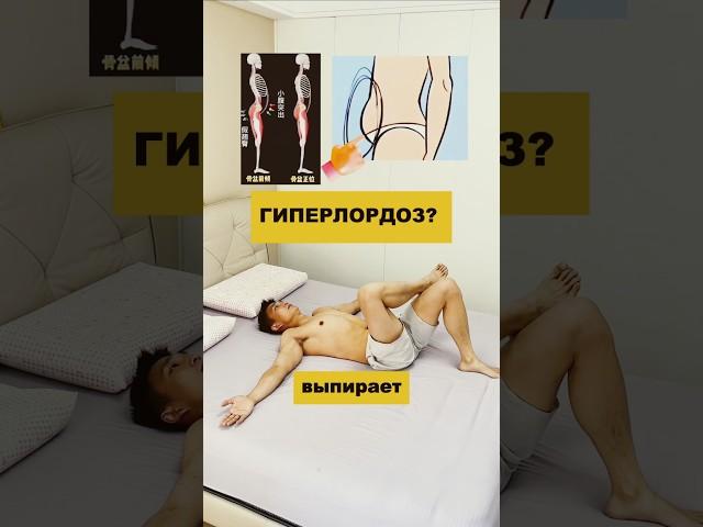 Гиперлордоз? #здоровье #гиперлордоз #долголетие #спина #омоложение