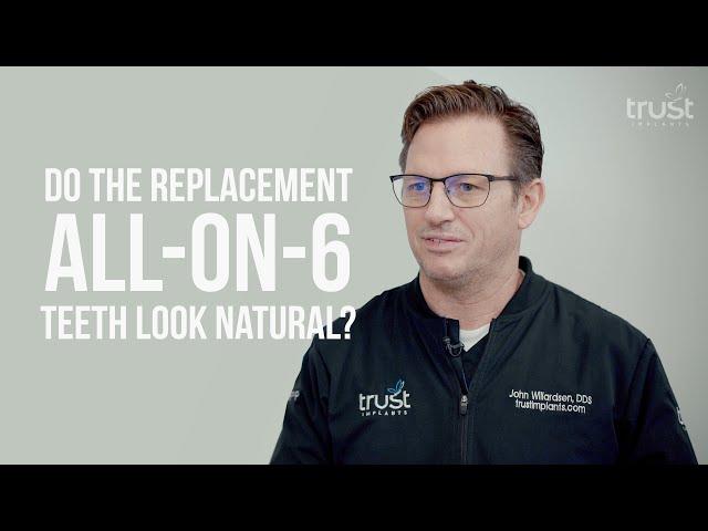 Do the replacement All-on-6 teeth look natural?