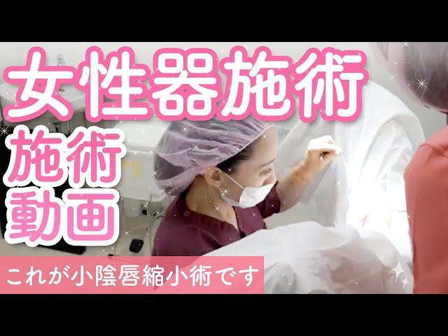 【小陰唇縮小術】施術解説動画大公開！女性器のお悩み解消！デリケートゾーンの施術！【VIO整形】