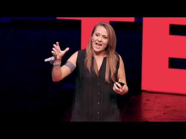 Why I Created a Third Thumb | Dani Clode | TEDxVienna