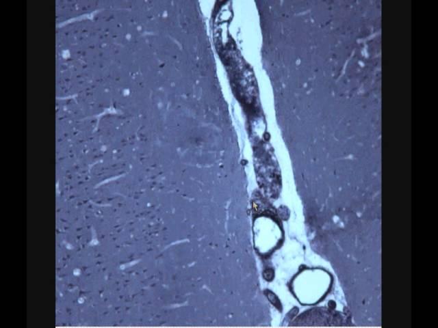 КОРА БОЛЬШИХ ПОЛУШАРИЙ ГОЛОВНОГО МОЗГА. Cerebral cortex.  Гистологическое строение
