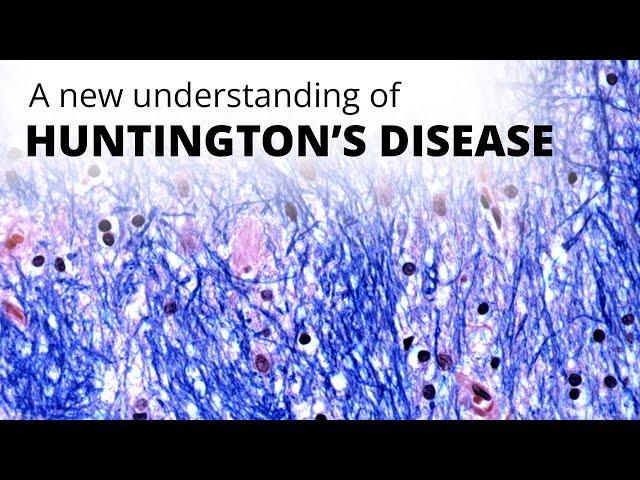 A new understanding of Huntington's disease