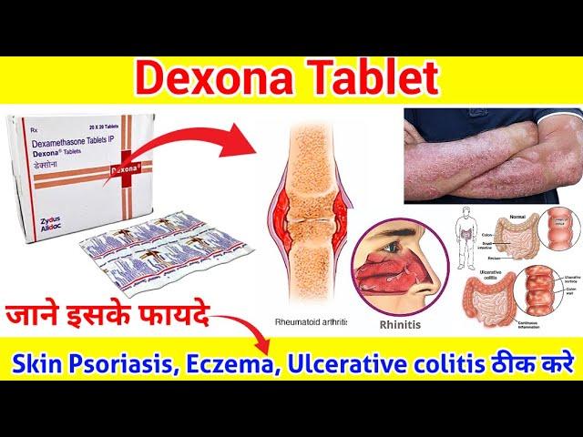 Dexona Tablet complete जानकारी ll Dexona Tablet के फायदे ll Dexona Tablet ll Pharma lectures ll