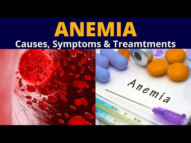 What is Anemia | Anemia causes | symptoms | Treatment |