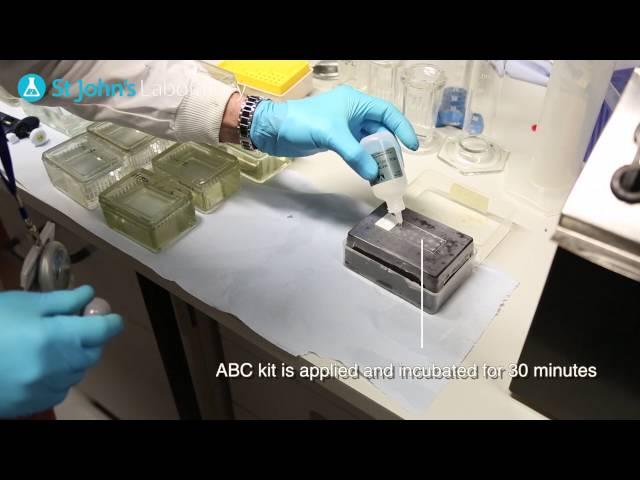 ImmunoHistoChemistry (IHC) - Video Protocol Series