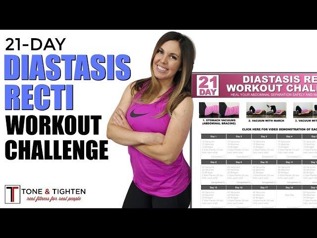 21-Day Diastasis Recti Workout Challenge - Post Pregnancy Ab Challenge