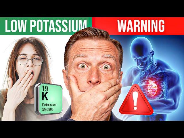 The POTASSIUM Epidemic: Dr. Berg Explains Symptoms, Signs, Diet, Causes, and Treatment