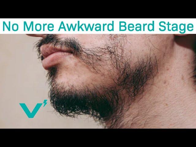 Skip The "Awkward Beard Stage" With These Tips