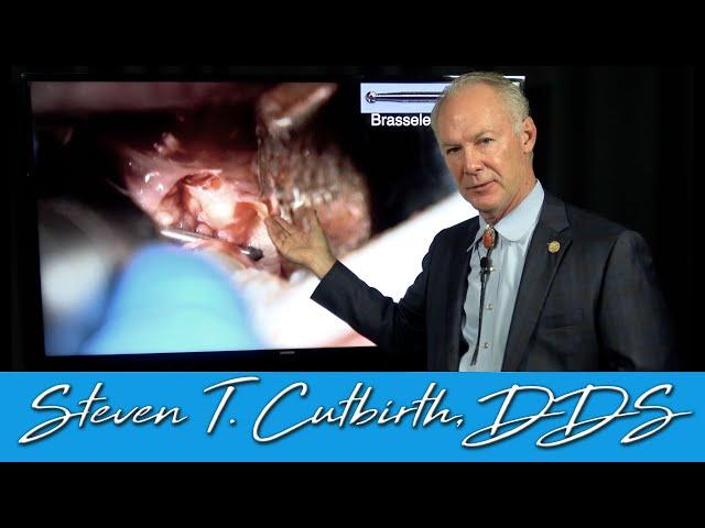 Most Difficult Wisdom Tooth I Have Ever Extracted - Dental Minute with Steven T. Cutbirth, DDS