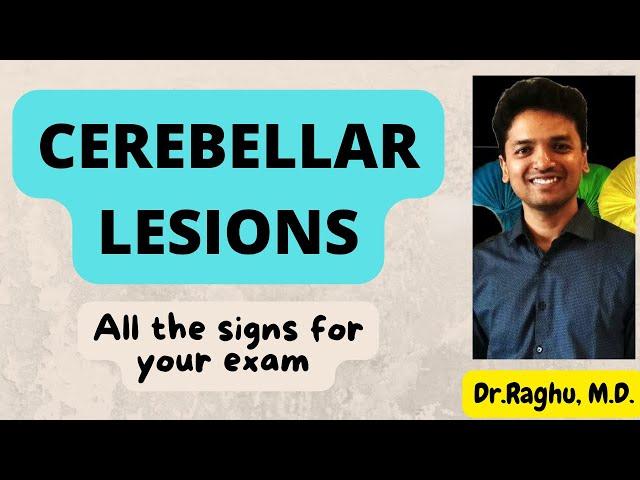 Cerebellar disorder | Signs of cerebellar dysfunction | Neurology | Cerebellar lesion