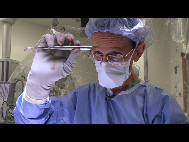 Repairing a Brain Aneurysm Behind the Eye