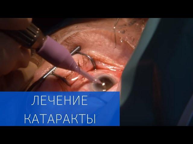 Хирургическое лечение катаракты в ЕМС