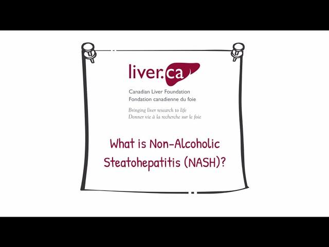 Non-alcoholic steatohepatitis (NASH) - Liver Disease Educational Video Series