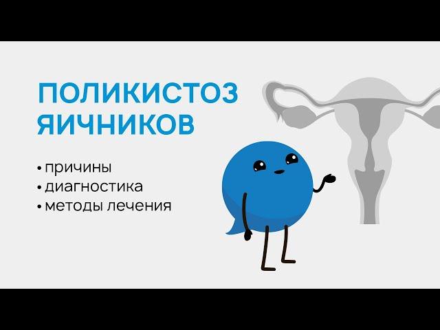 Поликистоз яичников