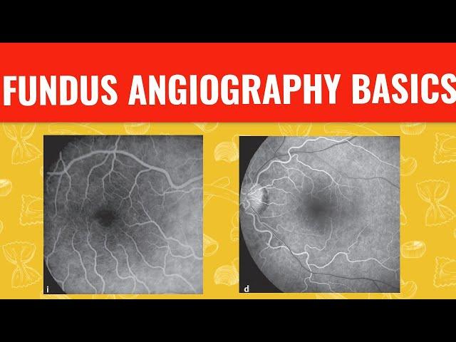 FFA course  || FUNDUS FLUORESCEIN ANGIOGRAPHY ||